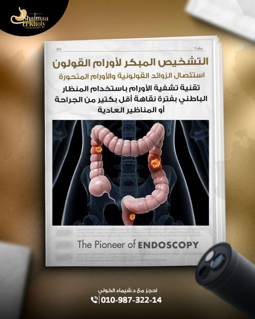 افضل دكتور لعلاج لحمية القولون بالمنظار